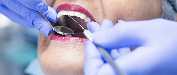 Best Urgent Care for Lost Fillings or Crowns in Ashland, OH
